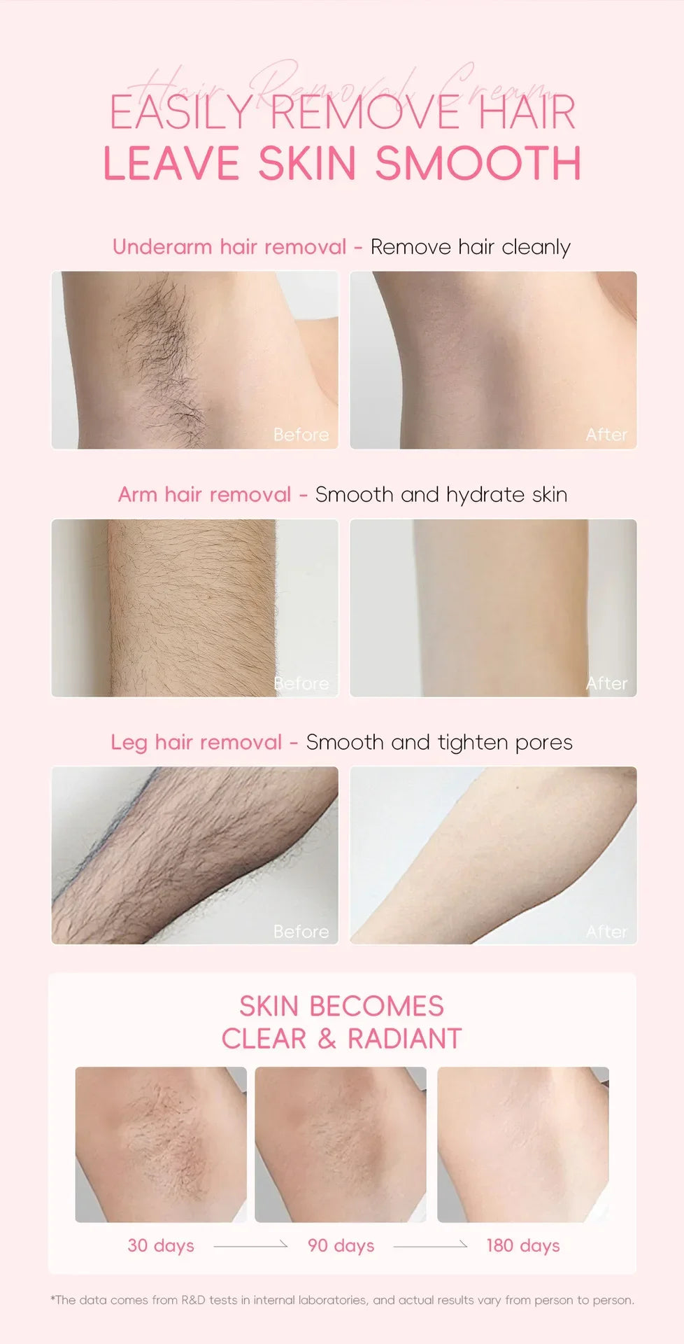 LAIKOU Hair Removal Cream Intimate Areas Epilator Cream Painless Health Hair Remover Growth Inhibitor Men Woman Body Care 50g